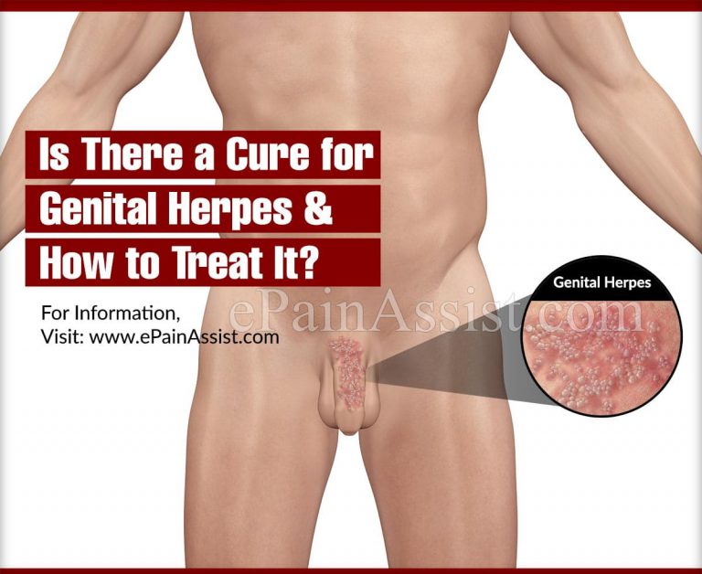 Is There a Cure for Genital Herpes & How to Treat It?
