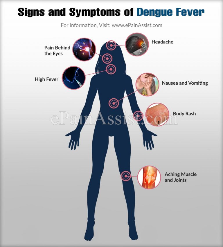 Signs and Symptoms of Dengue Fever  & Ways To Prevent Dengue Fever