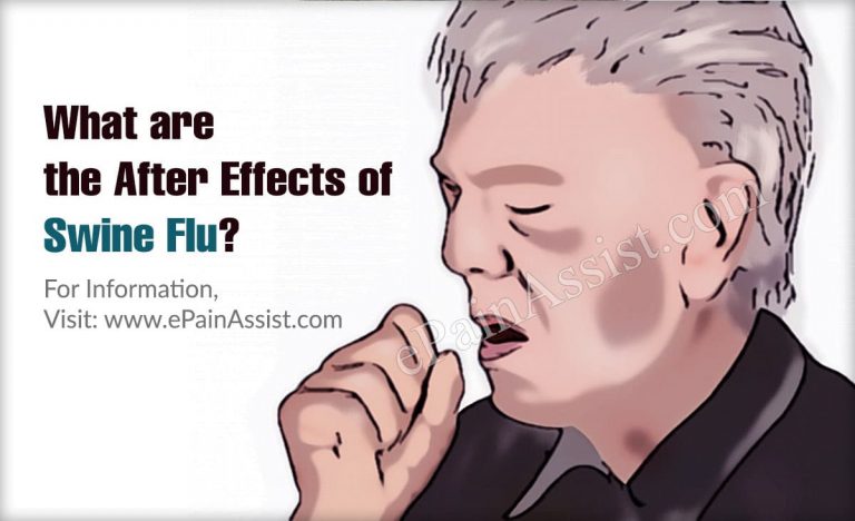 What are the After Effects of Swine Flu?