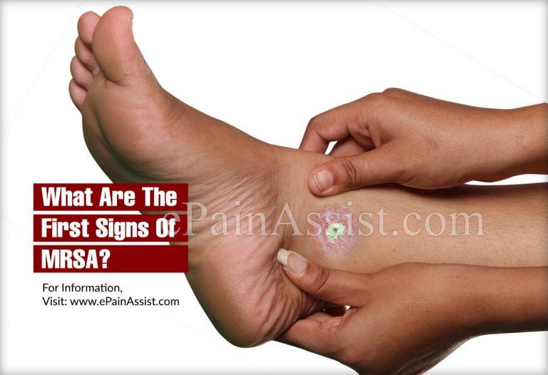 What Are The First Signs Of MRSA?
