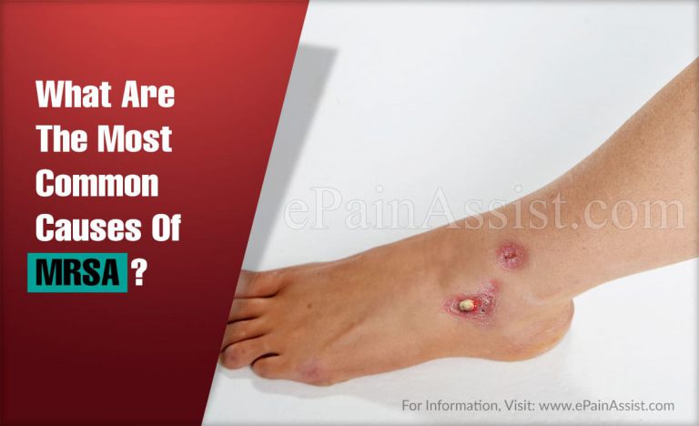 What Are The Most Common Causes Of MRSA?