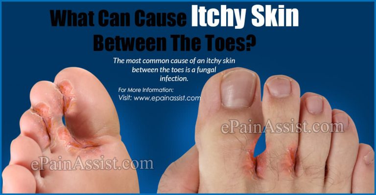 Itchy Skin Between the Toes: Causes, Treatment, Prevention