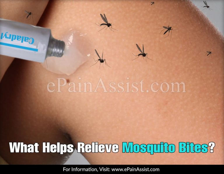 What Helps Relieve Mosquito Bites?