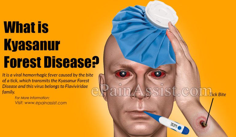 What is Kyasanur Forest Disease: Causes, Symptoms, Treatment, Transmission, Incubation Period, Risk Factors, Prevention
