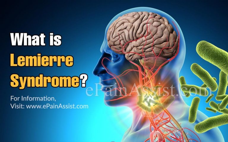 What is Lemierre Syndrome & How is it Treated?| Causes,Symptoms, Diagnosis of Lemierre Syndrome