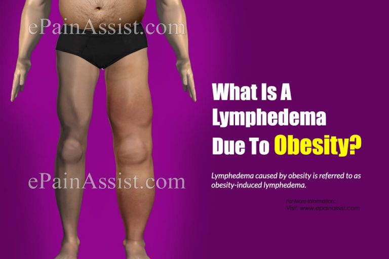 What Is A Lymphedema Due To Obesity?