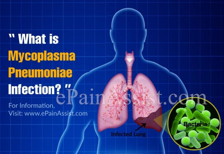 What is Mycoplasma Pneumoniae Infection, Know its Symptoms and Treatment Options