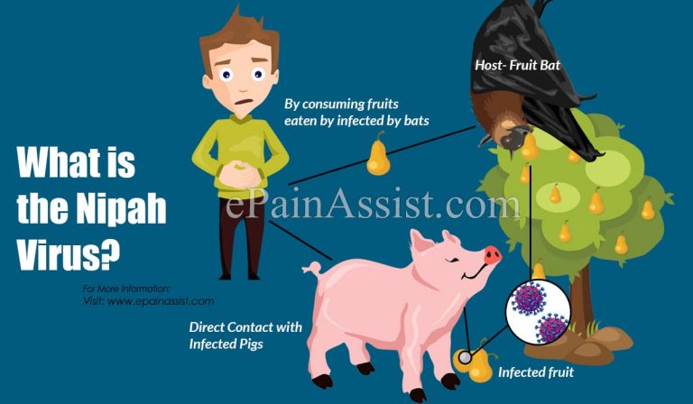 What Is Nipah Virus & How Is It Transmitted?|Symptoms, Treatment of Nipah Virus