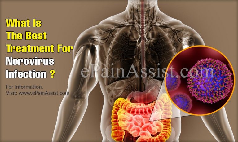 What Is The Best Treatment For Norovirus Infection?