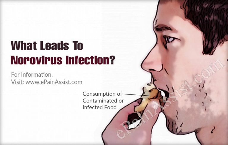 What Leads To Norovirus Infection & Can It Be Cured?