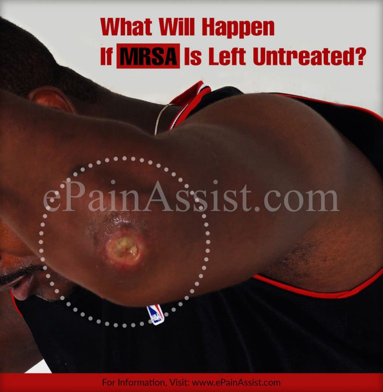 What Will Happen If MRSA Is Left Untreated?