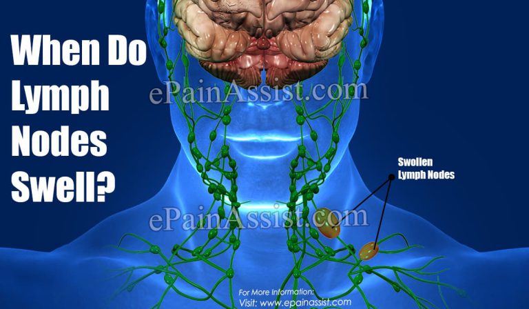 Swollen Lymph Nodes And When To Worry About Them