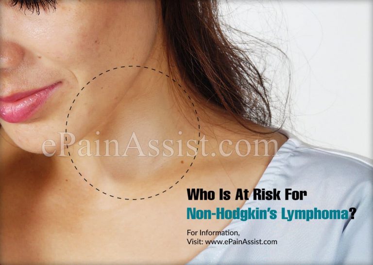 Who Is At Risk For Non-Hodgkin’s Lymphoma?