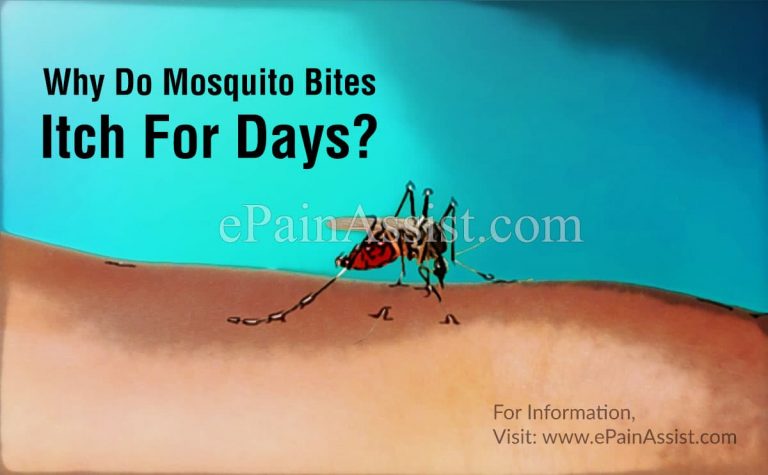 Why Do Mosquito Bites Itch For Days?