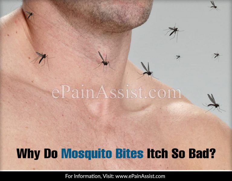 Why Do Mosquito Bites Itch So Bad?