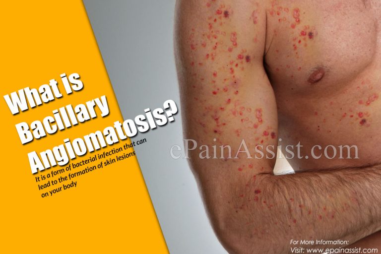 Bacillary Angiomatosis: Symptoms, Causes, Treatment, Epidemiology, Diagnosis