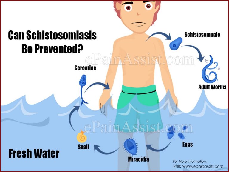 Can Schistosomiasis Be Prevented?