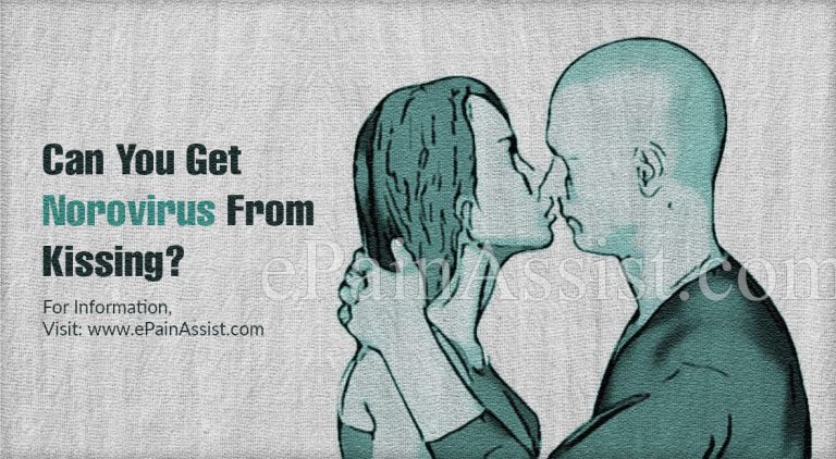 Can You Catch Norovirus Infection Twice & Can You Get Norovirus From Kissing?