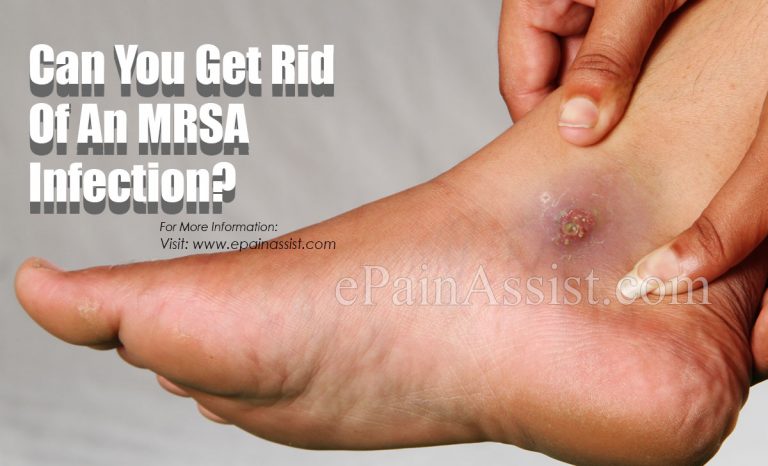 Can You Get Rid Of An MRSA Infection?