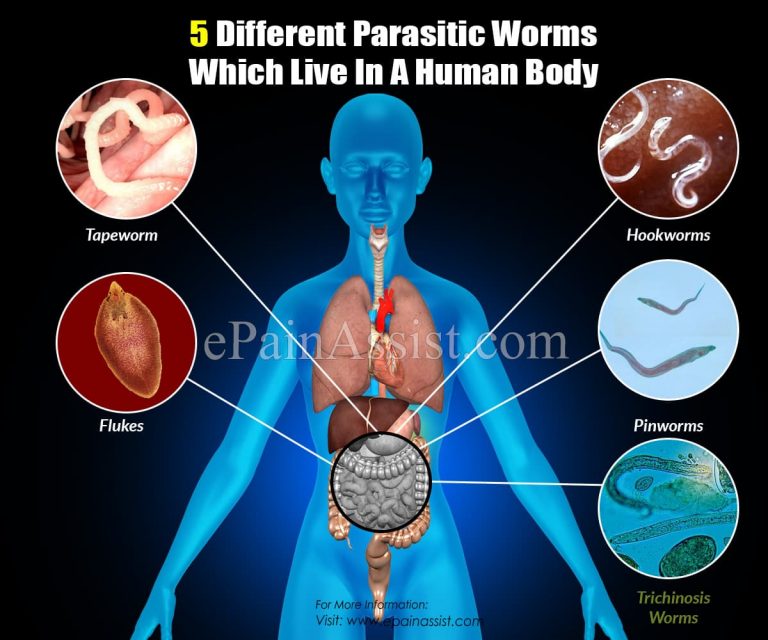 5 Different Parasitic Worms Which Live In A Human Body