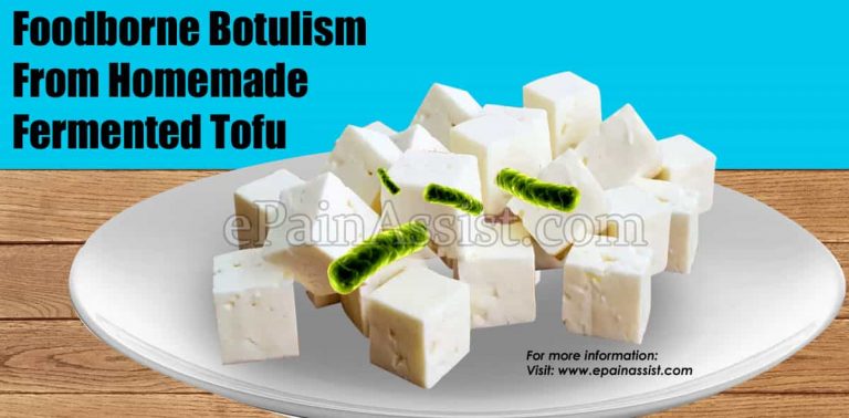 Foodborne Botulism From Homemade Fermented Tofu