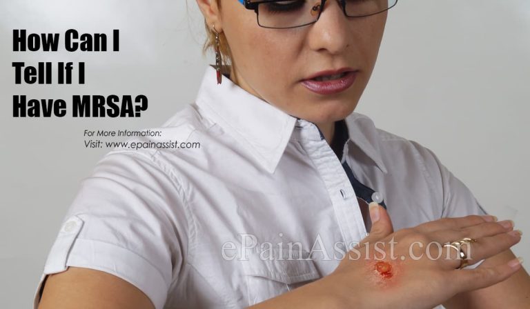 How Can I Tell If I Have MRSA?