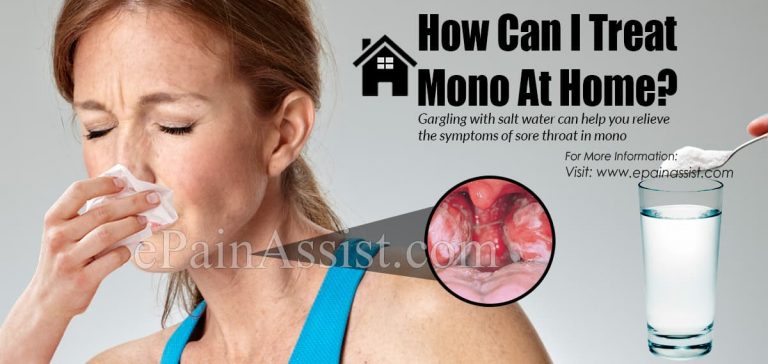 How Can I Treat Mono At Home?
