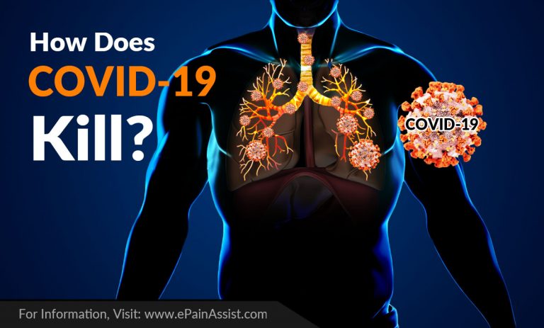 How Does COVID-19 Kill?