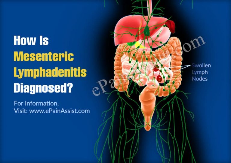 How Is Mesenteric Lymphadenitis Diagnosed?