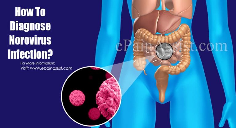 How To Diagnose Norovirus Infection & What Is The Best Medicine For It?