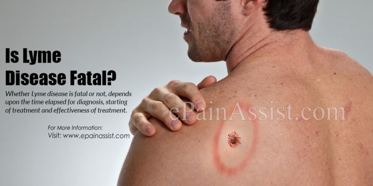 Is Lyme Disease Fatal?