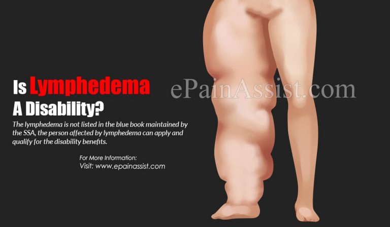 Is Lymphedema A Disability?