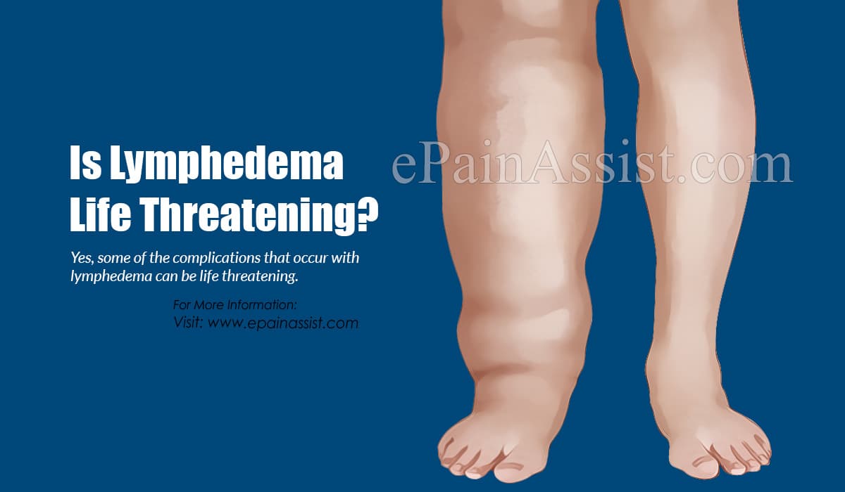 Is Lymphedema Life Threatening?