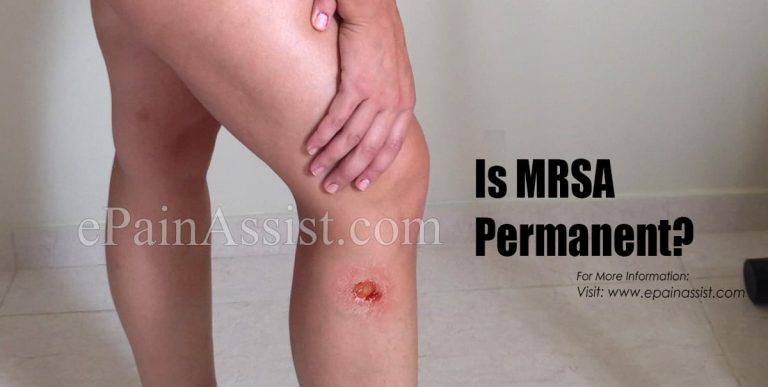Is MRSA Permanent?