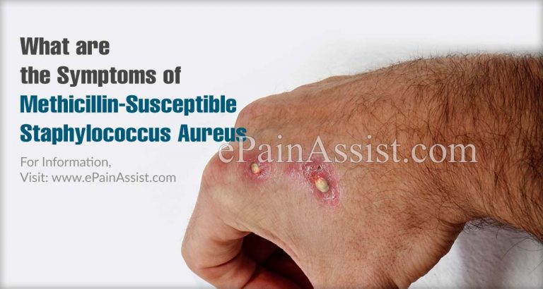 What Is Methicillin-Susceptible Staphylococcus Aureus (MSSA): Causes, Symptoms, Treatment, Diagnosis, Complications