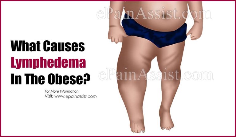 What Causes Lymphedema In The Obese?