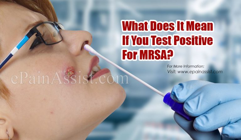 What Does It Mean If You Test Positive For MRSA?