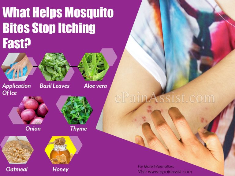 What Helps Mosquito Bites Stop Itching Fast?