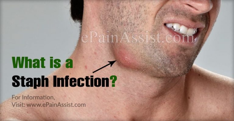 Recognizing and Treating A Nasal Staph Infection