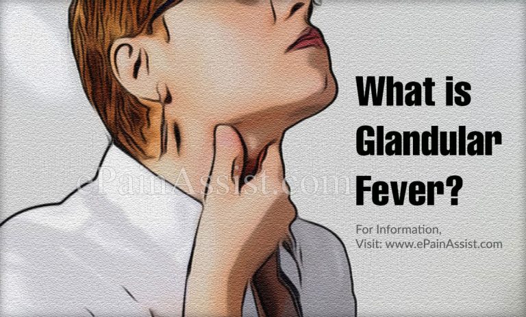 What is Glandular Fever & How is it Treated? | Causes & Symptoms of Glandular Fever