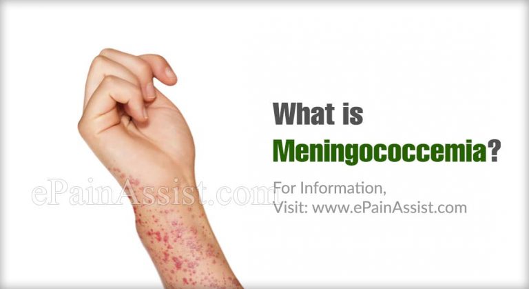 Meningococcemia: Causes, Symptoms, Treatment