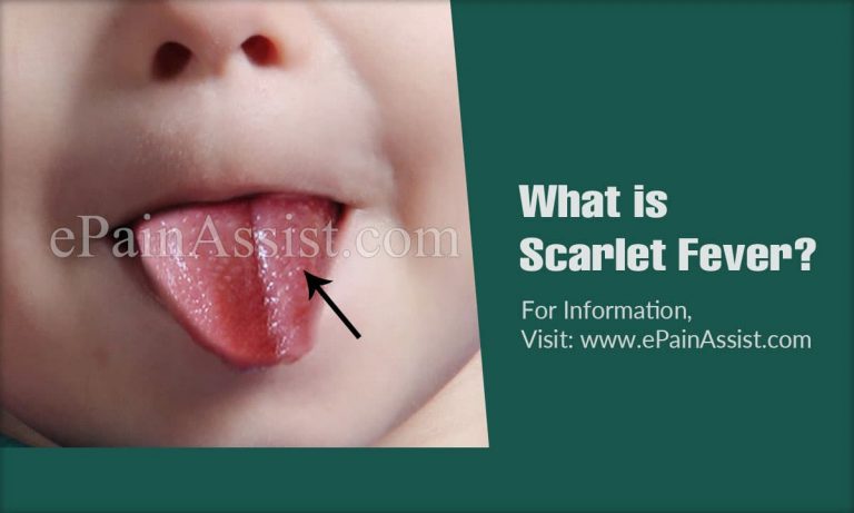 Scarlet Fever: Causes, Symptoms, Treatment