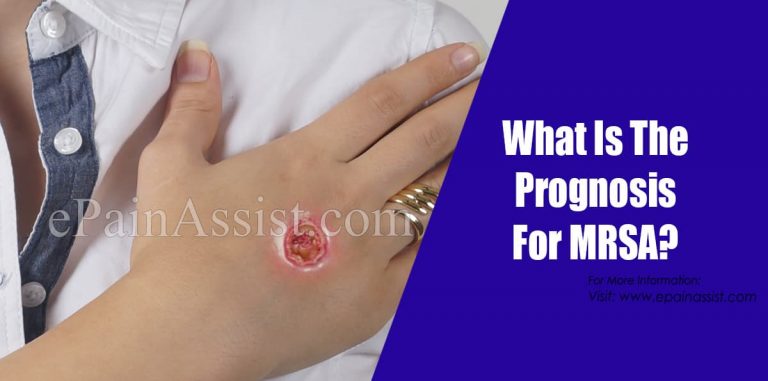 What Is The Prognosis For MRSA?