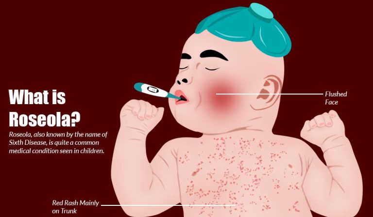 Roseola: Causes, Symptoms, Treatment, Complications