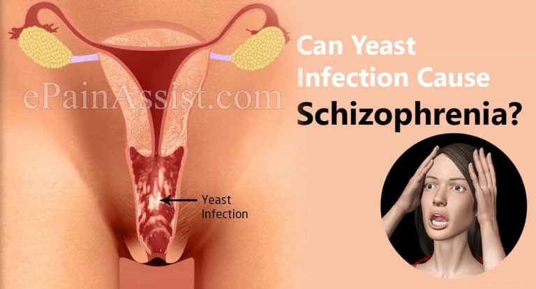 Can Yeast Infection Cause Schizophrenia?