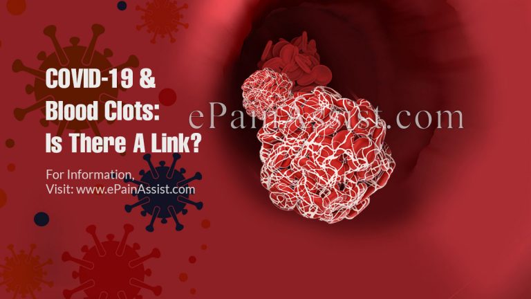 COVID-19 & Blood Clots: Is There A Link?