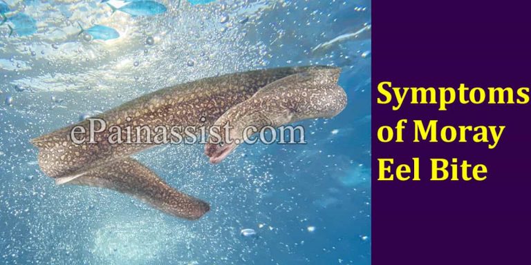 Symptoms of Moray Eel Bite