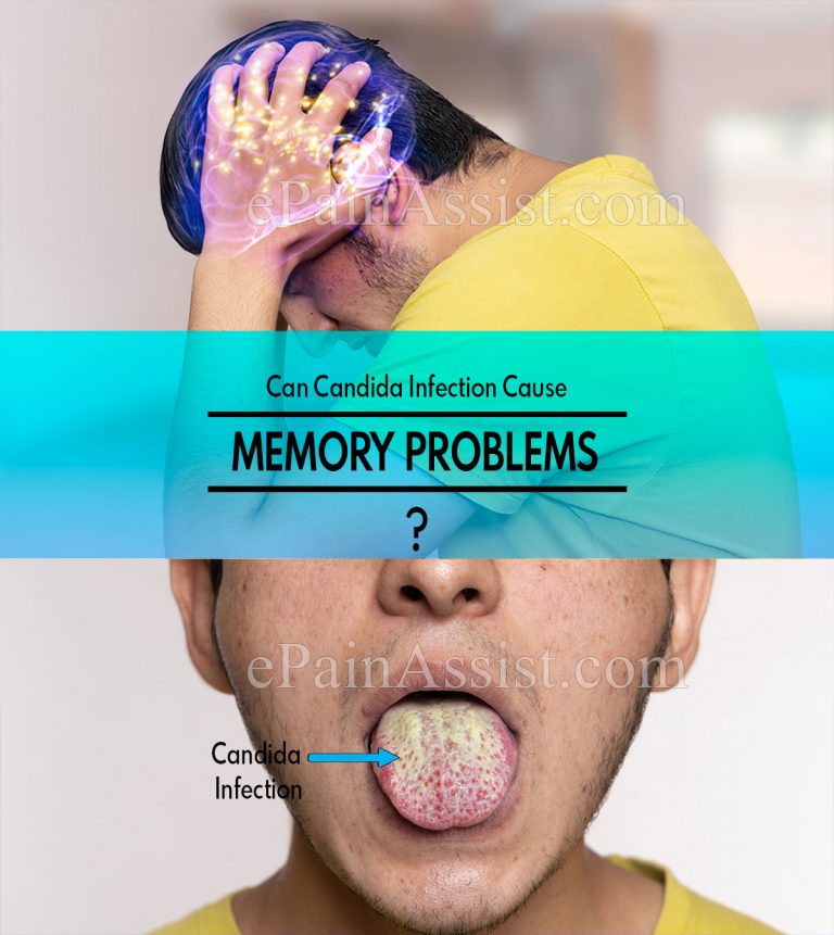 Can Candida Infection Cause Memory Problems?