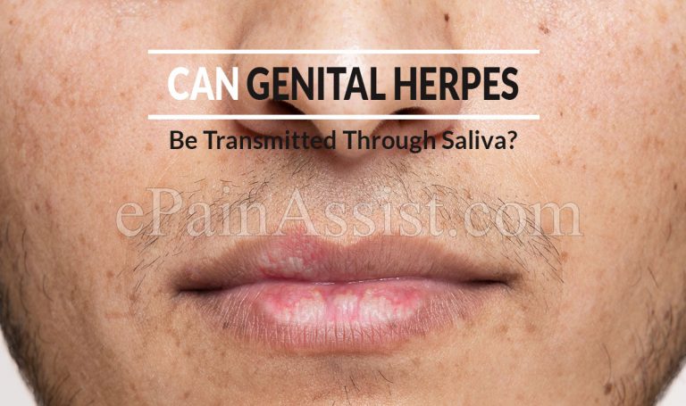 Can Genital Herpes Be Transmitted Through Saliva?