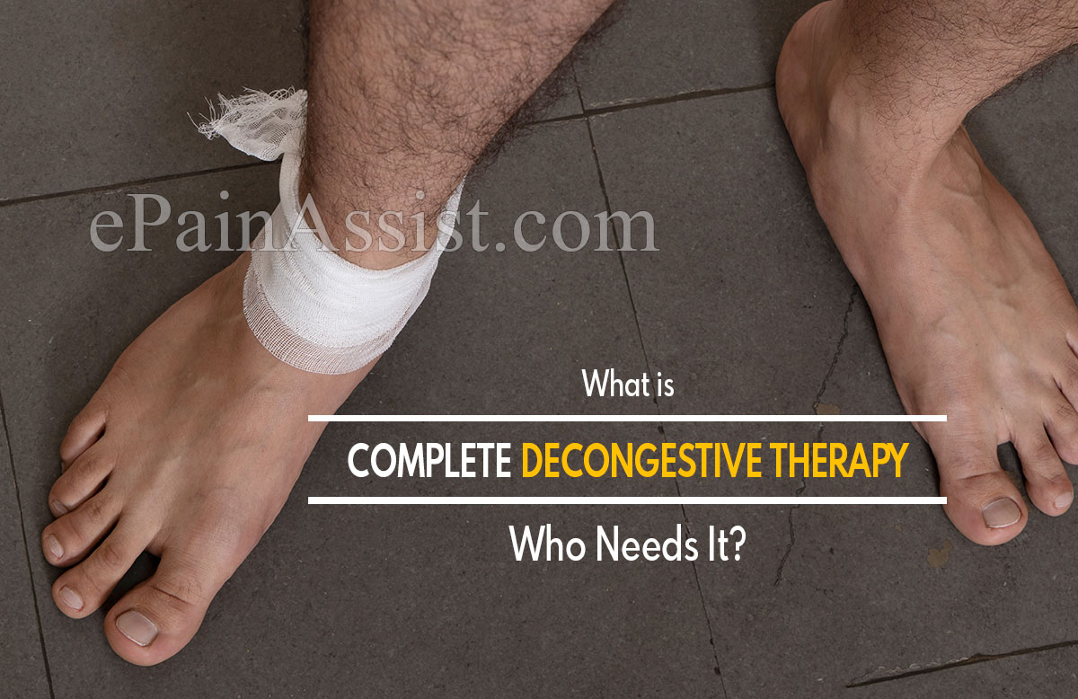 What is Complete Decongestive Therapy & Who Needs It?